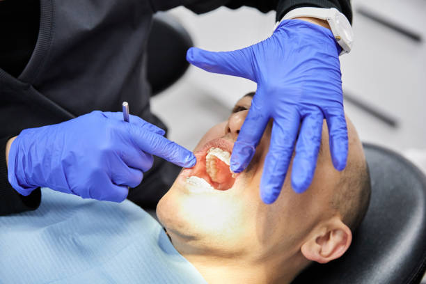 Best Emergency Dental Extractions in Hilmar Irwin, CA